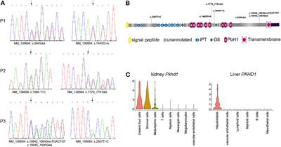 Identification of Genetic Predisposition in Noncirrhotic Portal Hypertension Patients With Multiple Renal Cysts by Integrated Analysis of Whole-Genome and Single-Cell RNA Sequencing